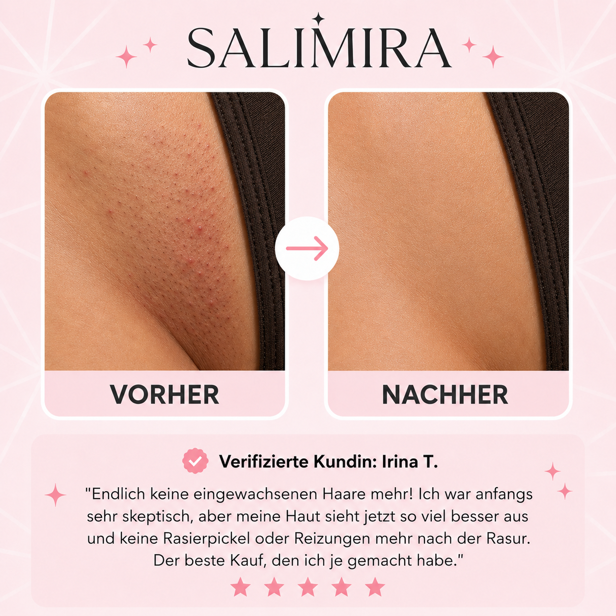 SmoothShave Pro – Summer Starter Set